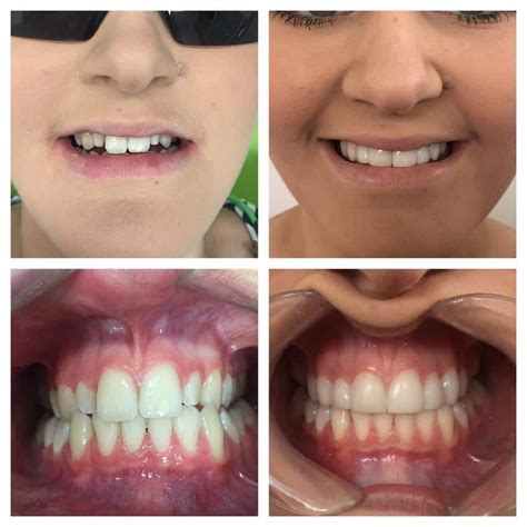 Uncover the Secrets of a Cheerful Face with Magic Dentist McAllen TX